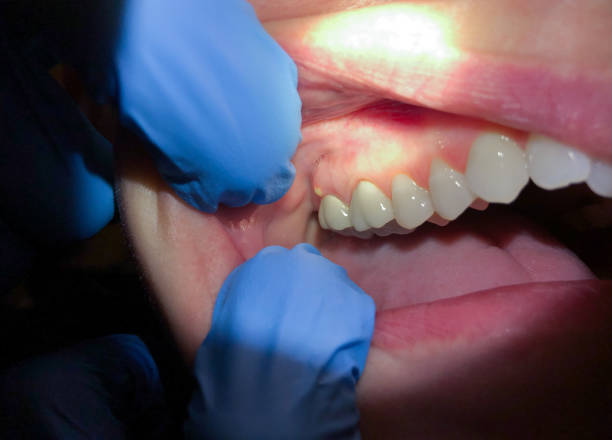 Best Weekend Emergency Dentist in New London, CT