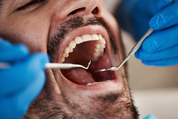 Best Emergency Tooth Extraction in New London, CT