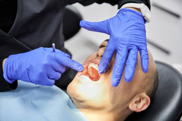 Best Emergency Broken Tooth Repair in New London, CT
